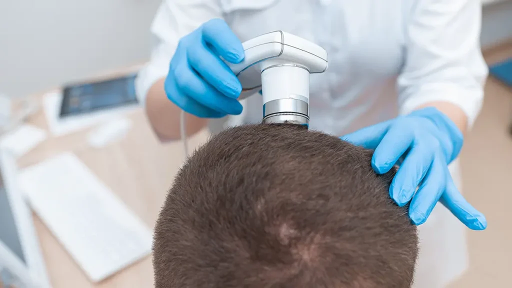 5 Hair Loss Treatments