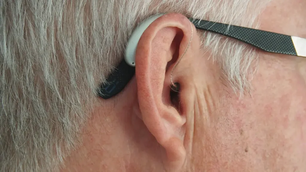 Transition to Hearing Aids