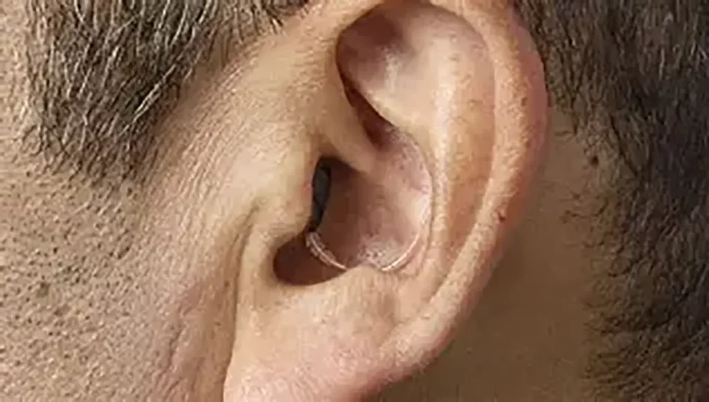 Oticon Zeal Hearing Aids 2